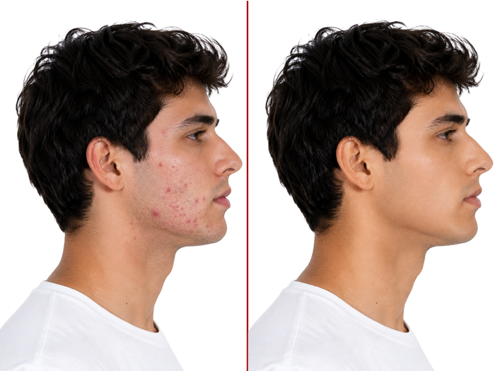 Antes y después de Alejandro Ruiz