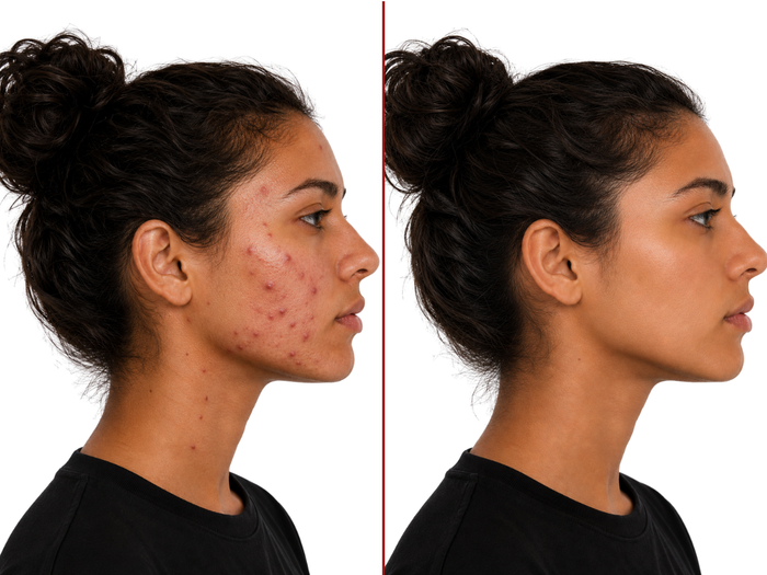 Antes y después de Camila Navarro